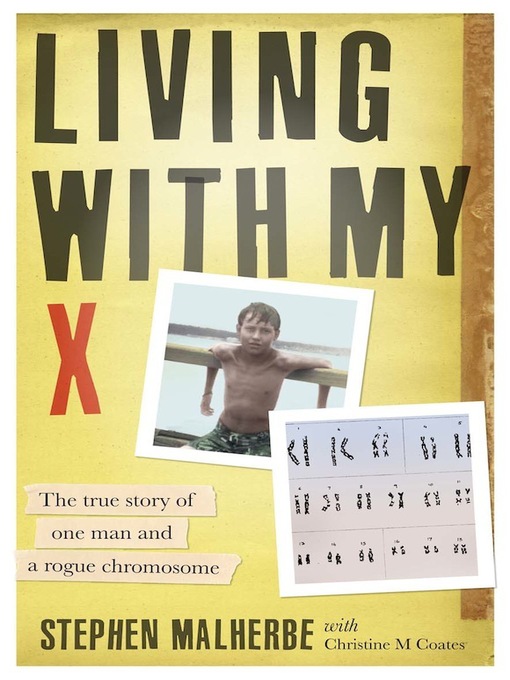 Title details for Living with My X by Stephen Malherbe - Available